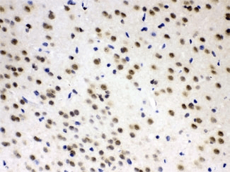 AZIN2 / Antizyme Inhibitor 2 Antibody