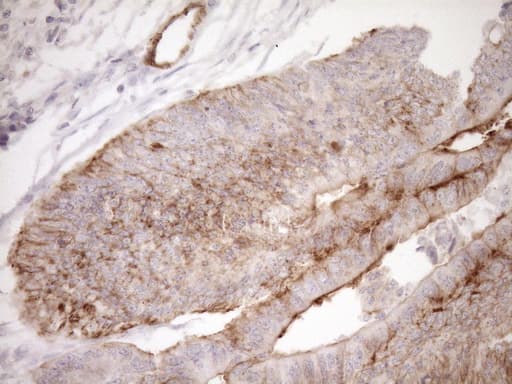 Monoclonal Mouse anti-Human EPLIN Antibody (clone OTI6F7, aa1-275, IHC, WB)
