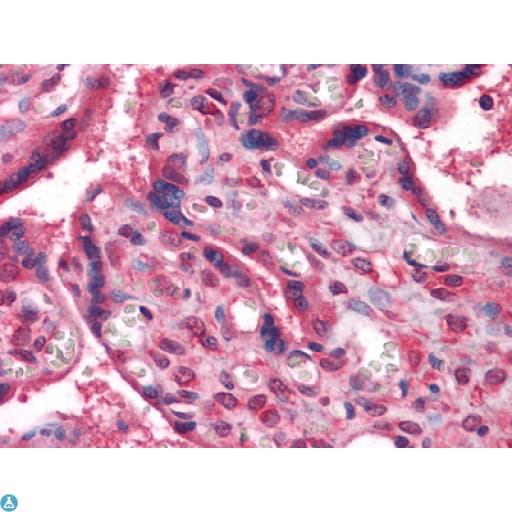 NME1 / NM23 Antibody