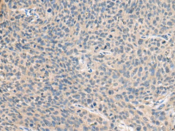 Polyclonal Rabbit anti-Human Ribonuclease A / RNASE1 Antibody (IHC, WB)