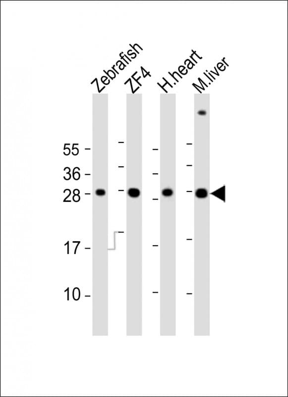 AK2 / Adenylate Kinase 2 Antibody (aa147-183)