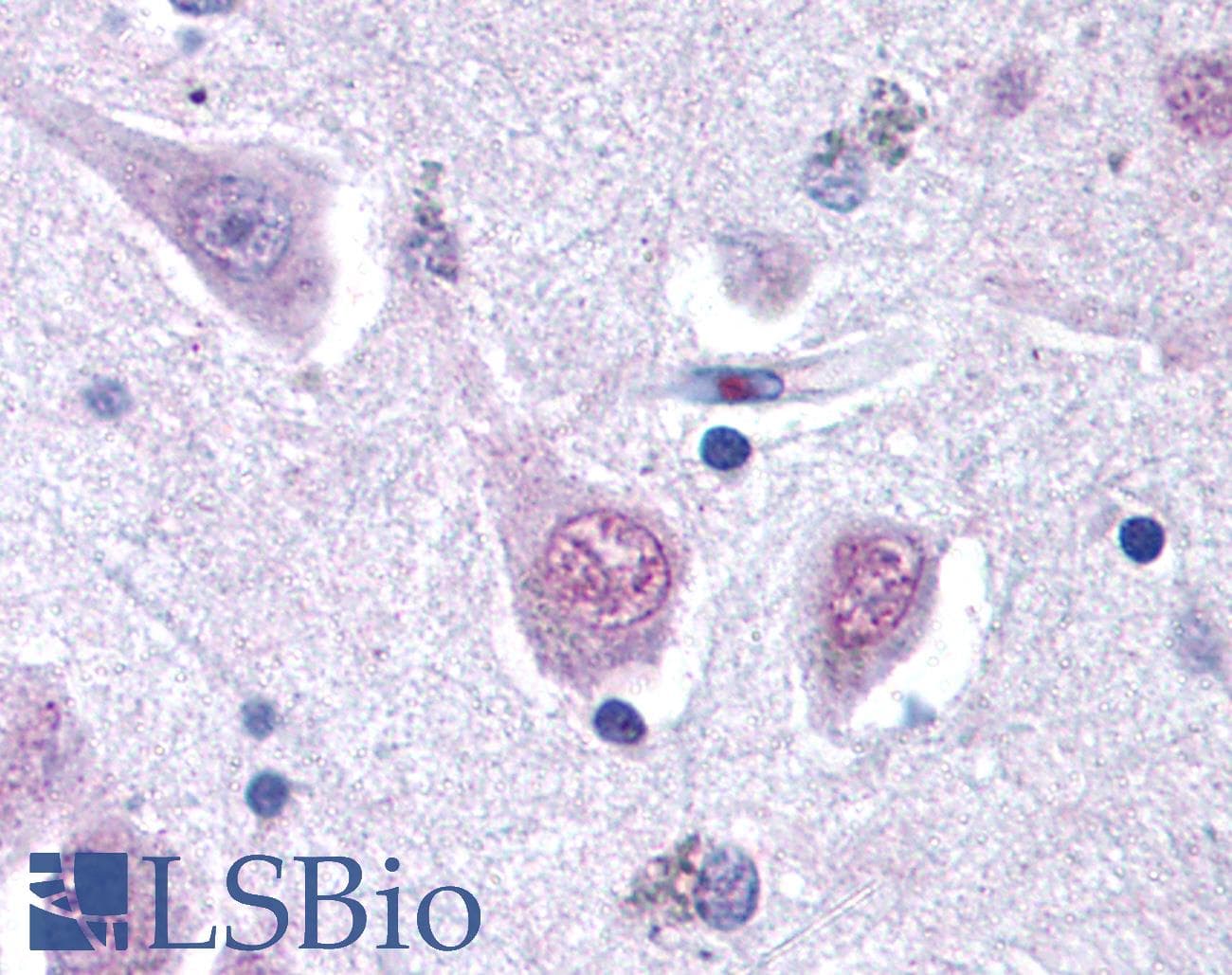 IHC-plus™ RGS2 Antibody (aa1-50)