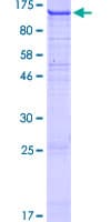 Human DDR2 Protein (Recombinant GST)