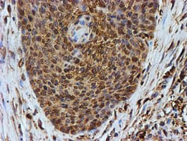 PSMB9 Antibody (aa21-219, clone OTI1D1)