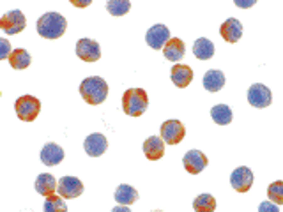 IHC-plus™ XBP1 Antibody