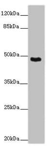 Polyclonal Rabbit anti-Human SMOC1 Antibody (IHC, IF, WB)
