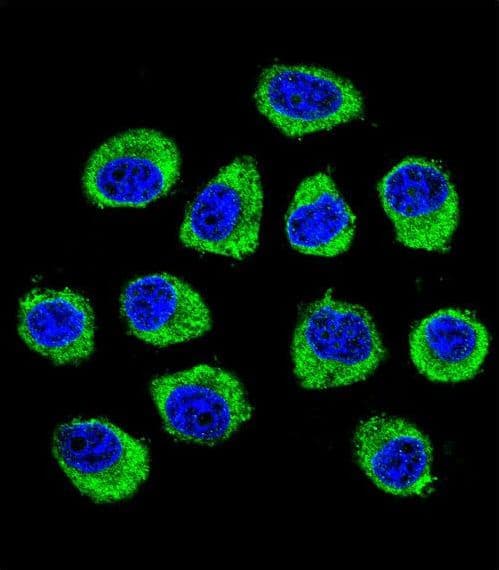 Polyclonal Rabbit anti-Human CNIH2 Antibody (aa31-59, IHC, IF, WB)