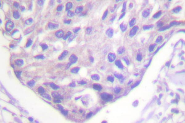 FOXO1+3+4 Antibody (Pro18/26)