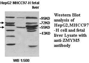 Polyclonal Rabbit anti-Human ZMYM5 Antibody (aa1-208, WB)