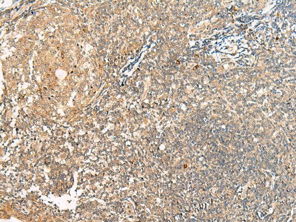 Polyclonal Rabbit anti-Human HEBP1 Antibody (IHC, WB)