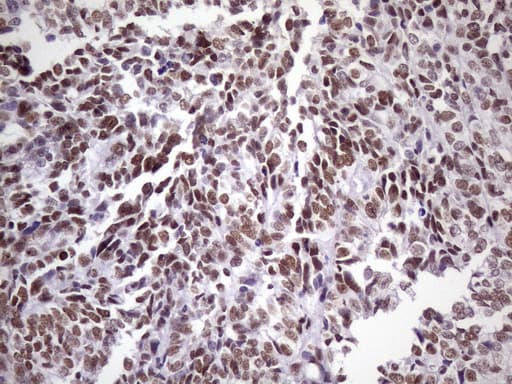 NUDT21 Antibody (aa2-227, clone OTI1B1)