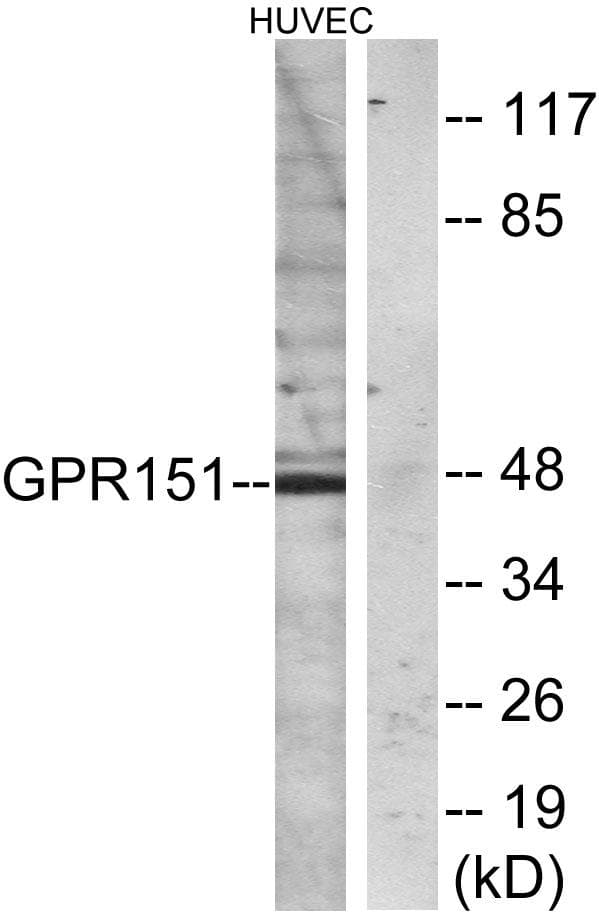 GPR151 Antibody