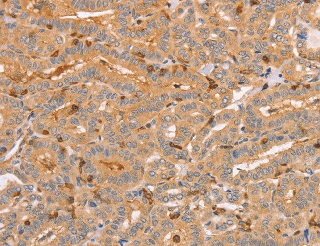 CCL16 / LEC Antibody