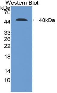 AQP4 / Aquaporin 4 Antibody (aa178-317)
