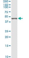 BGN / Biglycan Antibody (clone 4E1-1G7)