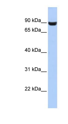 LRFN5 Antibody (aa287-336)