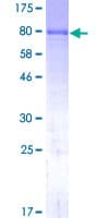 Human ALPL / Alkaline Phosphatase Protein (Recombinant GST)