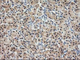PDXK / PNK Antibody (clone OTI3G2)