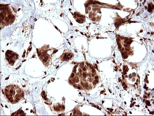 LZIC Antibody (aa1-190, clone OTI3A7)