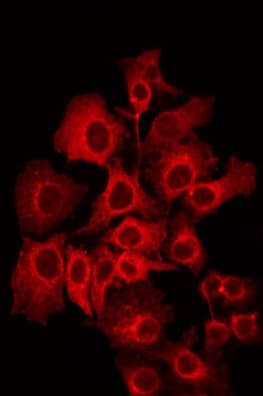 PIPOX / Sarcosine Oxidase Antibody