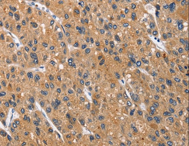 Polyclonal Rabbit anti-Human CD66d / CEACAM3 Antibody (IHC)