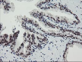 Monoclonal Mouse anti-Human TPRKB Antibody (clone OTI1E9, IHC, WB)