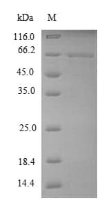 Dog MMP13 Protein (Recombinant 6His-SUMO, N-terminus)