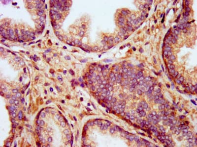 KCNT1 / KCa4.1 Antibody