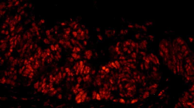 DFFA / ICAD / DFF45 Antibody (aa271-331)