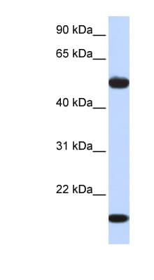 ADSSL1 Antibody (aa144-193)