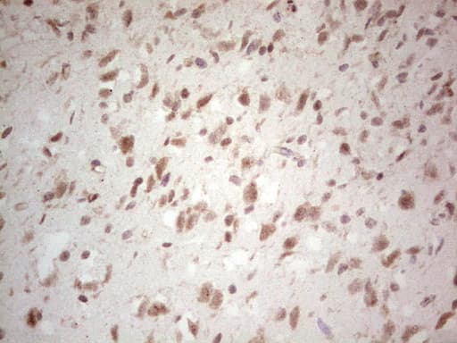 NEFM / NF-M Antibody (aa413-773, clone OTI5B7, Carrier-free)
