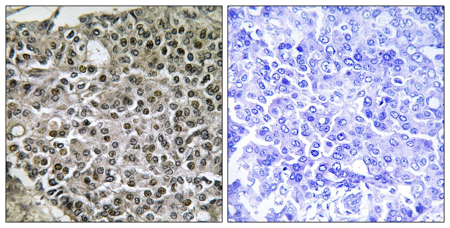 NFATC4 / NFAT3 Antibody (p676)