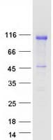 Human NOLC1 Protein (Recombinant Myc-DDK (Flag))