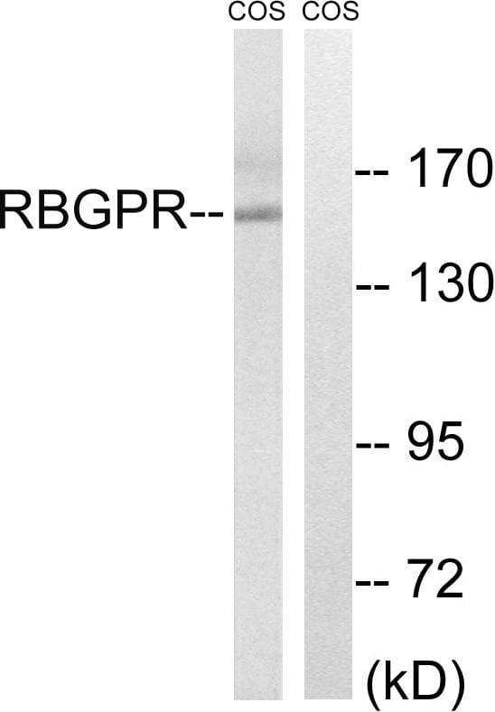 RAB3GAP2 / p150 Antibody