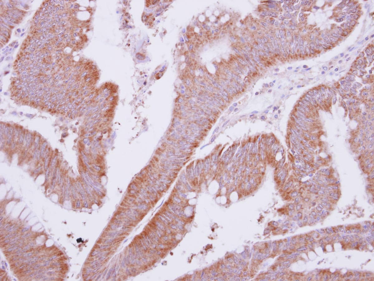 MTMR9 Antibody