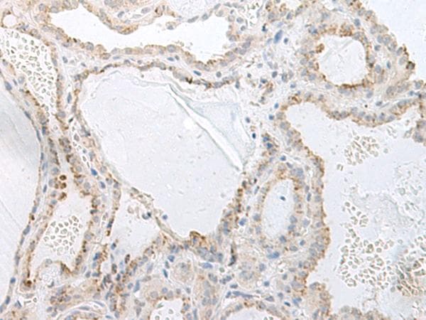 Polyclonal Rabbit anti-Human GASP2 / GPRASP2 Antibody (IHC)