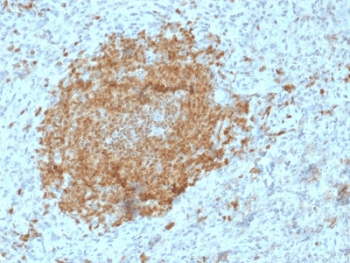 Monoclonal Mouse anti-Human POU2AF1 / BOB1 Antibody (clone BOB1/2425, IHC, WB)