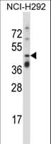 Polyclonal Rabbit anti-Human TNFRSF10A / DR4 Antibody (aa418-446, WB)