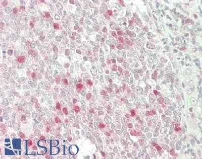 IHC-plus™ SH2D1A / SAP Antibody