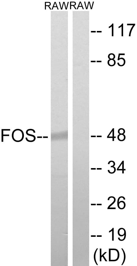IHC-plus™ FOS / c-FOS Antibody (aa201-250)