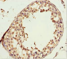 Polyclonal Rabbit anti-Human L2HGDH Antibody (IHC, WB)
