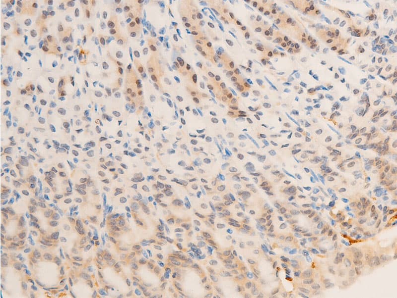 EGFR Antibody (phospho-Ser1071)