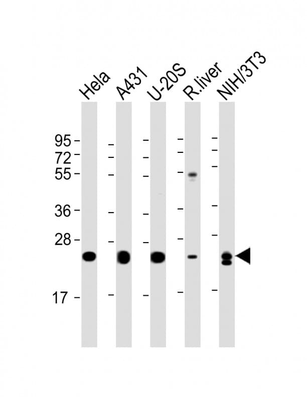 RAB1B Antibody (clone 1673CT571.17.71)