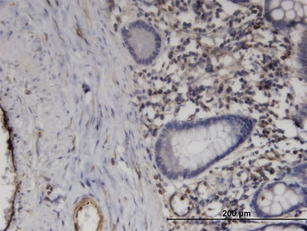 Monoclonal Mouse anti-Human PRGP1 / PRRG1 Antibody (clone 1C7, IHC, WB)