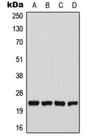 Polyclonal Rabbit anti-Human CHAC1 / MGC4504 Antibody (N-Terminus, WB)