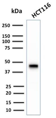 PathPlus™ Recombinant Monoclonal Rabbit anti-Human KRT18 / CK18 / Cytokeratin 18 Antibody (clone KRT18/2808R, IHC, IF, WB)