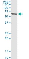 SERPINB2 / PAI-2 Antibody (clone 3A9)