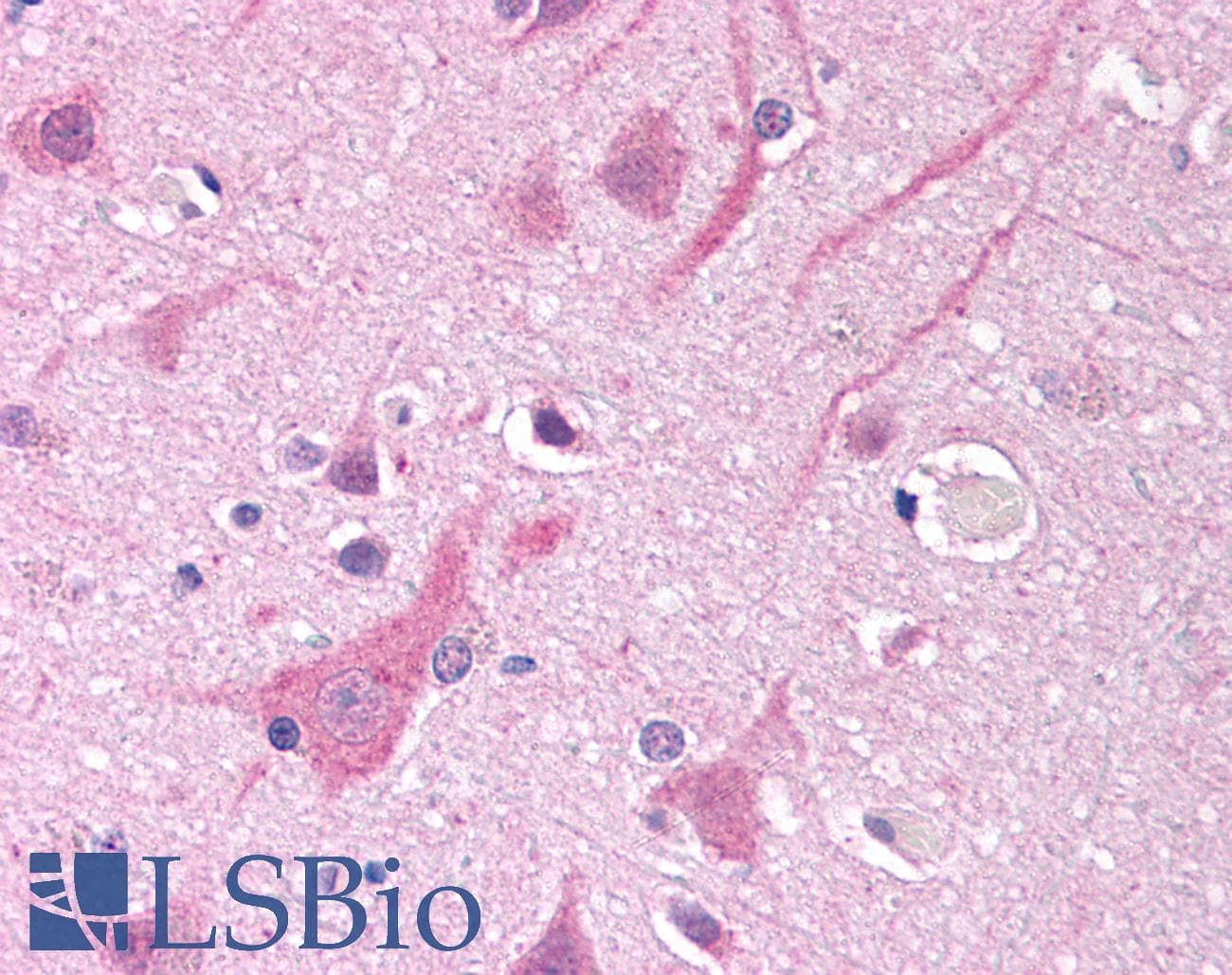 IHC-plus™ Polyclonal Goat anti-Human SCN5A / Nav1.5 Antibody (aa1548-1558, IHC)