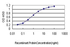 Monoclonal Mouse anti-Human HARS Antibody (clone 1C8, IF, WB)
