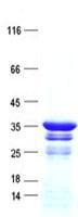 Human SIX1 Protein (Recombinant His, N-Terminal)